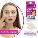 Acne Patch - Spot Dots 72 Count, Hydrocolloid Bandages, Acne Pimple Care Patches Absorbing Round Pads, Blemish Covers MEDca