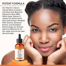 100% PURE VITAMIN C SERUM FOR FACE, Anti Aging Serum with Hyaluronic Acid, Vitamin E, MSM, Aloe Vera, Jojoba Oil, Amino Blend, Hydrating Serum for Dark Spots, Fine Lines and Wrinkles, Skin Repair, Pore Clearing, Acne Scars, Organic Vegan Ingredients - DOU Infinity Warehouse