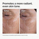 The Ordinary Glycolic Acid 7% Exfoliating Toner, Brightening And Smoothing Daily Toner For More Even-Looking Skin Tone Infinity Warehouse