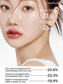 Medicube 30ml Korean Cosmetics Exosome Essence | 7500ppm Intensive Care/Advanced Users | Microcrystal Radiant Essence | Liquid Skin Strengthening Essence | Exosome, AHA+BHA+PHA | Pore Care, Pore Tightening, Dead Skin Cell Removal, Skin Improvement | Korea Infinity Warehouse