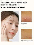 ANUA Rice 70 Luminous Cream Toner, Suitable For Glassy Skin And Brightening, Rice Water, Niacinamide, Ceramide, Panthenol, Fragrance-Free, Non-Comedogenic, Korean Skin Care 250ml Infinity Warehouse