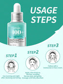 ANUA 7 Niacinamide & Rice Barrier Repair Essence, 50ml. Rice Extract Compound Formula, Lightweight & Absorbent Texture, Moisturizing & Soothing, Suitable For Sensitive Skin Care During Seasonal Changes Infinity Warehouse