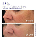 iS CLINICAL Brightening Complex, Skin Brightening Complex, Addresses Age Spots Infinity Warehouse