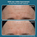 Lancer Skincare The Method Intro Kit, 3-Step Anti-Aging Facial Exfoliator, Cleanser, and Moisturizer Kit for Glowing Skin, Reveals Healthy-Looking Glowing Skin Infinity Warehouse