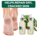 nu119 How to Get Soft Feet | Foot Care Kit Includes 120ml Instant Foot Peel Spray for Calluses Removal, Softening Balm & File | Professional Products to Make Your Feet Soft Infinity Warehouse