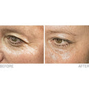 Look 10 years younger in minutes with Genesphere which lifts wrinkles out from below Infinity Warehouse