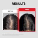 Dr.FORHAIR Folligen Thickening Scalp Serum 1.7 oz | Biotin Density Serum for Thicker, Fuller-Looking Hair | Peptide Scalp Treatment | Korean Haircare Infinity Warehouse
