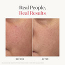 Facial Treatment Essence - Anti-Aging Essence Skincare to Help Reduce the Appearance of Fine Lines & Wrinkles - Visibly Refines Texture & Improves Firmness & Dark Spots Infinity Warehouse