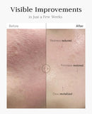 Nuborn Cell Placenta Stem Cell Intensive Repair Cream | Dragon Blood Cream with Placental Extract | Collagen Korean Skin Care for Glass Skin (50ml) Infinity Warehouse