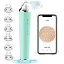 Blackhead Remover Pore Vacuum with Camera, [FDA Certification] Black Head Remover Suctioner 3 Suction Power & 6 Probes, WiFi Real-Time Skin Screen,Upgraded Pimple Vacuum Acne Comedone Extractor CLEASO