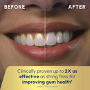Waterpik Cordless Advanced 2.0 Water Flosser For Teeth, Gums, Braces, Dental Care With Travel Bag and 4 Tips, ADA Accepted, Rechargeable, Portable, and Waterproof, Gray WP-587, Packaging May Vary Infinity Warehouse