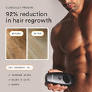 NEW Nood™ Flasher 2.0 + Serum — IPL Laser Hair Removal Device for Women & Men with After Shave to Treat & Prevent Ingrown Hairs, Bumps Slowing Hair Regrowth — Pain-Free IPL Hair Removal — Gloss White Infinity Warehouse