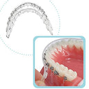Tecnidentusa Clip-On Comfort Lip Shield/Mouth Protector Guard for Braces Dental Wax Alternative TecnidentUSA Affordable Quality Orthodontics Suppliers