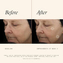 SkinMedica TNS Advanced+ Face Serum - Multi Peptide Serum to Help Improve the Appearance of Wrinkles, Fine Lines, Skin Tone & Texture (1 oz) Infinity Warehouse