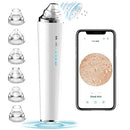 Blackhead Remover Pore Vacuum with Camera, [FDA Certification] Black Head Remover Suctioner 3 Suction Power & 6 Probes, WiFi Real-Time Skin Screen,Upgraded Pimple Vacuum Acne Comedone Extractor CLEASO