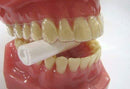 Aligner Chewies - White - Unscented (2 Count (Pack of 1), White) Ortho Brands