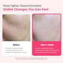 Dr.Melaxin Pink Spicule Cyano Niacinamide Serum – Vitamin B12 Pore Minimizer, Liquid Microneedle Facial Treatment for Enlarged Pores, Microneedling Skin Renewal & Texture Refining (30ml) Infinity Warehouse
