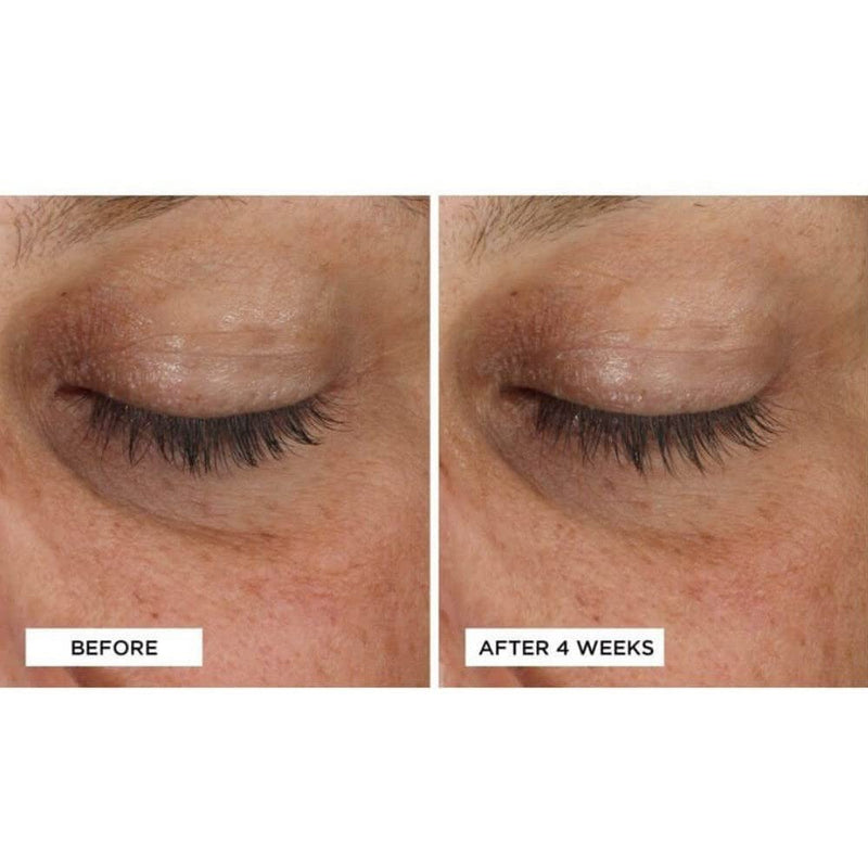 Perricone MD Cold Plasma Plus+ Advanced Eye Cream, 0.5 fl. oz. Infinity Warehouse