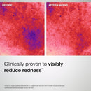 StriVectin Barrier Restore + Soothing Milky Face Mist with Ceramides + Hyaluronic Acid Infinity Warehouse