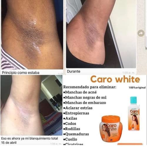 Caro White Set-3 (Lotion 10.14oz + Cream 10.14oz + Soap 6.3oz) Infinity Warehouse
