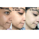 Original Kojie San Facial Beauty Soap - 65g, 2 Bars Per Pack - Guaranteed Authentic Kojie San