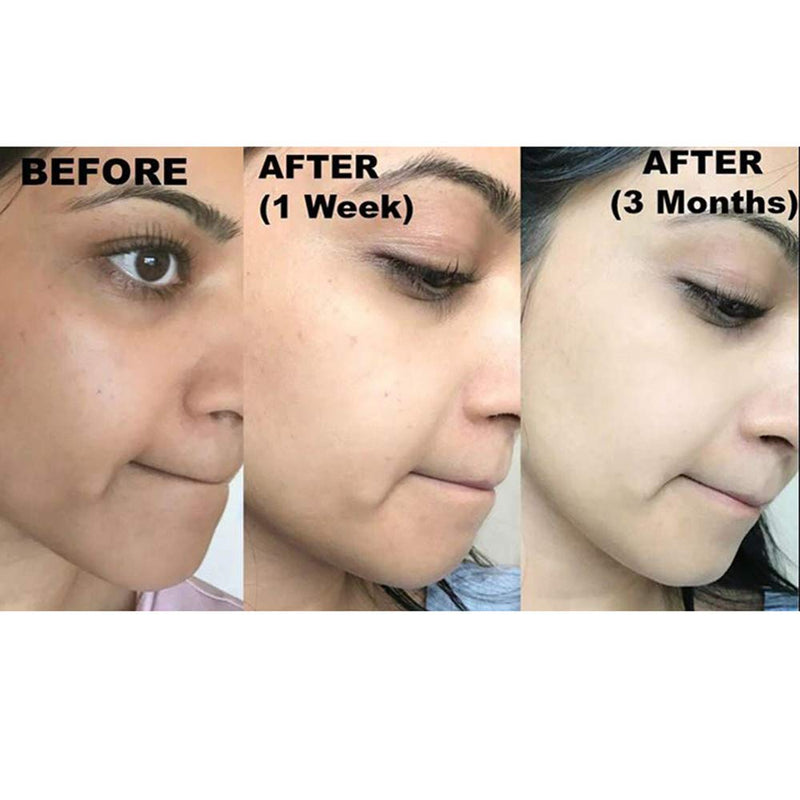 Original Kojie San Facial Beauty Soap - 65g, 2 Bars Per Pack - Guaranteed Authentic Kojie San