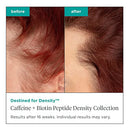 Briogeo Destined For Density Caffeine + Biotin Peptide Shampoo + Conditioner + Serum Bundle | Thicker, Fuller‑Looking Hair | Vegan, Silicone‑Free | 2 x 8 fl oz + 1.5 fl oz Infinity Warehouse