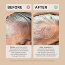 ACTIIV Thickening Hair Serum - Water Based | Supports the Appearance of Thicker, Fuller-Looking Hair, Lightweight Water-Based Formula, Non-Greasy, All Hair Types, 1.8 oz Infinity Warehouse