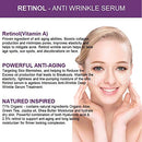 Dermaxgen Retinol Serum - Pure Organic Anti Aging, Anti Wrinkle Face Wrinkles | Renewing and Restore with Hyaluronic Acid, 1 fl oz DERMAXGEN