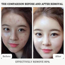 2PCS Rice Exfoliating Ampoule Set – Black & White Rice Brightening Duo for Glowing Skin | Gentle Peel + Pore Minimizing & Deep Hydration Infinity Warehouse