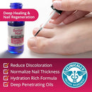 Better Nail - Treatment for Fungus Under & Around the Nail - Maximum Strength 25% Solution for Nail Support - Nail Restoring Solution Infinity Warehouse