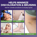 BIOCORNEUM Advanced Bruise Dietary Supplement – Internal Support for Visible Bruise Recovery – Professional Bruise Remedy with Arnica, Vitamins K1, K2, C, Zinc & Bromelain for Bruising and Swelling Infinity Warehouse