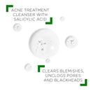 Vichy Normaderm Daily Acne Face Wash, Salicylic Acid Face Cleanser for Oily & Acne Prone Skin, Acne Cleanser that Clears Clogged Pores and Blackheads, Cleansing Gel for Clear Skin Vichy