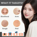 2PCS Rice Exfoliating Ampoule Set – Black & White Rice Brightening Duo for Glowing Skin | Gentle Peel + Pore Minimizing & Deep Hydration Infinity Warehouse