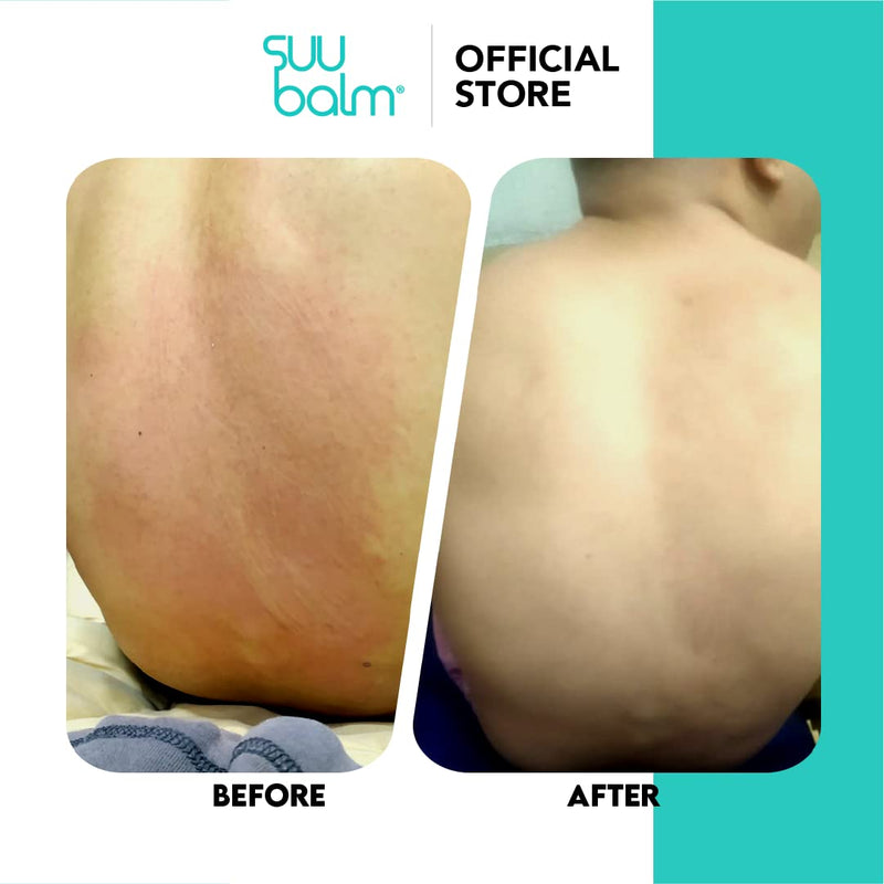 Anti Itch Body Wash, Eczema Bodywash for adults, Psoriasis Body Wash, Moisturising Cleanser for Dry Itchy Skin Relief, Derm-Formulated with Menthol & Shea Butter, Sulfate & Fragrance Free, 28.4 fl oz Infinity Warehouse