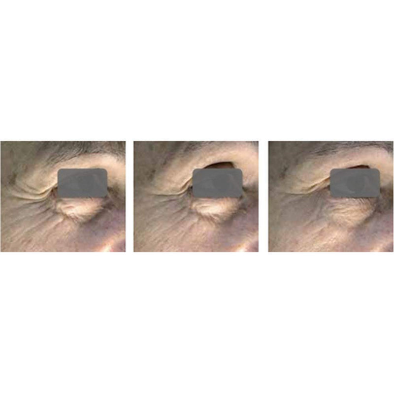 Ageless Beauty Instant Face Lift with Hyaluronic Acid | Acai Extract | Argireline | Matrixyl 3000 - Drastically Reduces Eye Bags, Wrinkles, Lines & Puffiness | Tighten Skin Instantly (10mL - 2 Vials) Nutrafeel