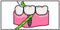 IDontix Brace X-Floss, Green Idontix