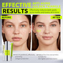 KKP Retinal Face Cream 10ML + Eye Cream 15ML+ Facial Serum 30ML,Suitable for all skin types 3 Set