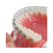 Tecnidentusa Clip-On Comfort Lip Shield/Mouth Protector Guard for Braces Dental Wax Alternative TecnidentUSA Affordable Quality Orthodontics Suppliers