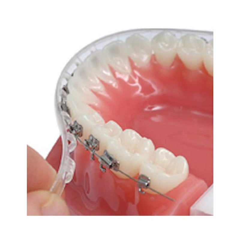 Tecnidentusa Clip-On Comfort Lip Shield/Mouth Protector Guard for Braces Dental Wax Alternative TecnidentUSA Affordable Quality Orthodontics Suppliers