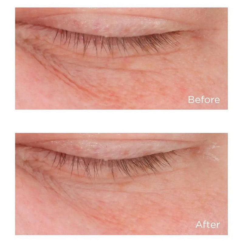 Perricone MD Cold Plasma Plus+ Advanced Eye Cream, 0.5 fl. oz. Infinity Warehouse