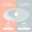 KILLA™ Kit by ZitSticka, translucent pimple patch for deep, early-stage zits, 4 pack ZitSticka