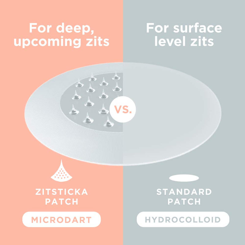 KILLA™ Kit by ZitSticka, translucent pimple patch for deep, early-stage zits, 4 pack ZitSticka