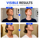 Micro Infusion System for Face, At-Home Skincare Kit with Peptides, Hyaluronic Acid & Tranexamic Acid, Gentle Surface-Level Care with 0.25mm Micro Stamp & Repair Mask, 1-Month Supply Infinity Warehouse