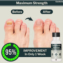 Anti-Fungal Foot & Finger Nails Fungus Treatment Maximum Strength Serum with Tolnaftate 1% – Fast Absorbing Athlete’s Foot & Fungal Skin Relief Solution – Non-Greasy Formula (30 mL) Infinity Warehouse