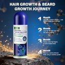 3 Pack 5% Minoxidil for Men and Women,Minoxidil Beard and Hair Growth Serum(Biotin-Infused) with Sponge Applicator for Thinning Hair and Sparse Beards,4-Month Supply 3 x 2.7 FL OZ Infinity Warehouse