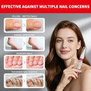 Toenail Fungus Treatment Extra Strength Nail Repair Pen, Repair Damaged Nails Yellow, Discolored, Thick and Ingrown Nails, Fungus Pen for Toenails and Fingernails with Tea Tree Oil, 3 Pens & 3 Files Infinity Warehouse