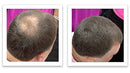 Caboki Hair Loss Concealer 30G (90-Day Supply) (Gray) Caboki