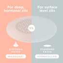KILLA™ Kit by ZitSticka, translucent pimple patch for deep, early-stage zits ZitSticka