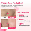 Dr.Melaxin Pink Spicule Cyano Niacinamide Serum – Vitamin B12 Pore Minimizer, Liquid Microneedle Facial Treatment for Enlarged Pores, Microneedling Skin Renewal & Texture Refining (30ml) Infinity Warehouse